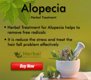 Herbal Treatment for Alopecia may help restore healthy hair growth. Herbal Remedies for Alopecia ...
