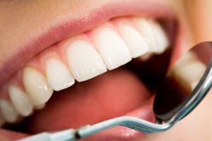OHI: Flossing with Traditional Braces | URBN Dental Houston TX