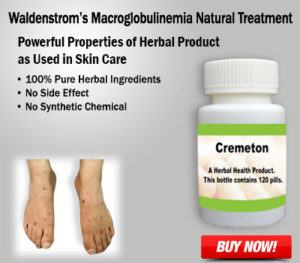 Natural Remedies for Waldenstrom’s Macroglobulinemia Risk Factors and Treatment